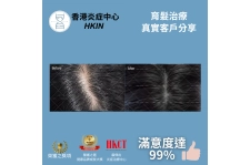 香港炎症中心_真實客戶分享_育髮治療3