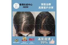 香港炎症中心_真實客戶分享_育髮治療