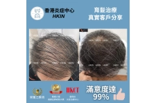 香港炎症中心_真實客戶分享_育髮治療2_